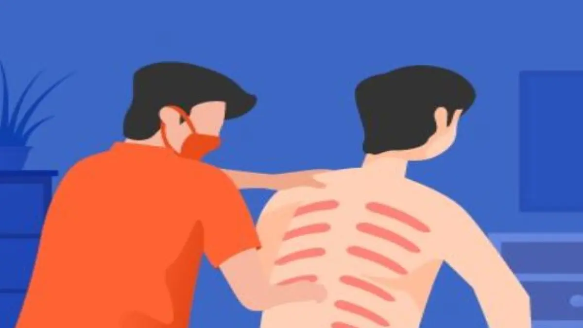 Obat Alami Masuk Angin Dewasa. (ILUSTRASI RADAR TULUNGAGUNG)
