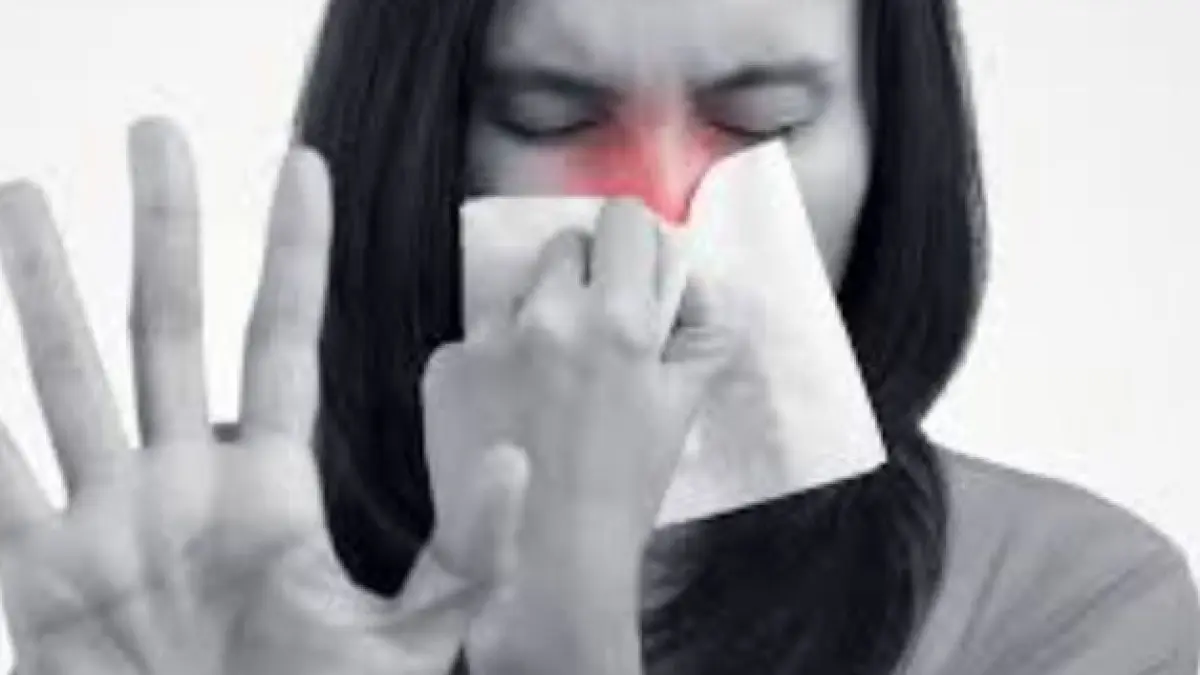 Ilustrasi hidung tersumbat. (ISTIMEWA)