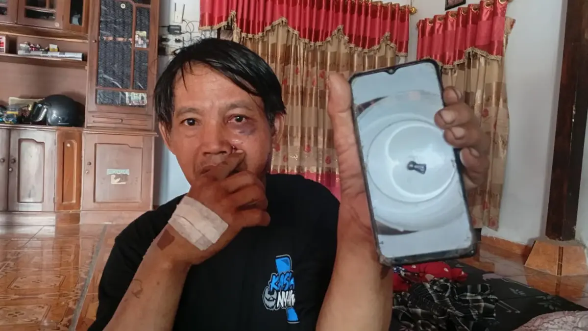 KORBAN: Sutrisno menunjukkan bekas luka di wajah setelah diduga terkena peluru senapan angin nyasar saat mencari rumput di area persawahan Kecamatan Kebonsari. DIAN RAHAYU/RADAR MADIUN