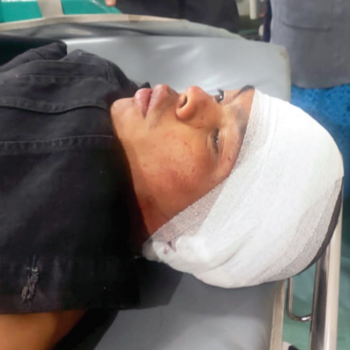 AA alias Bendil, yang menghabisi temannya sendiri dalam duel berdarah di Buring Malang