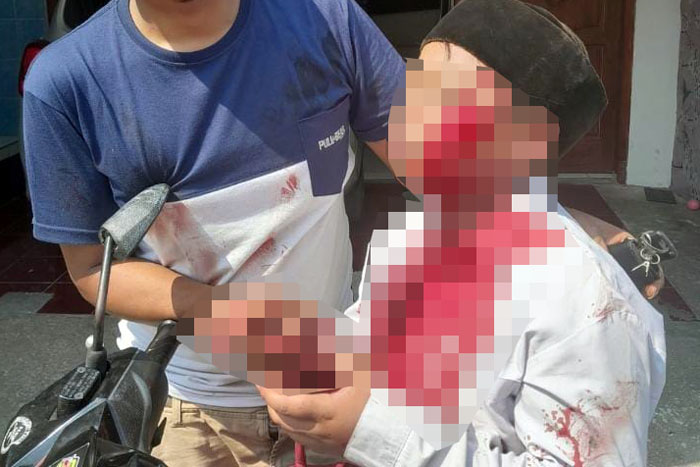 Foto mozaik bocah korban disayat teman sekolahnya sendiri di MI Jalan Brawijaya Tegalweru Dau Malang. Gambar diblur karena luka sangat parah.