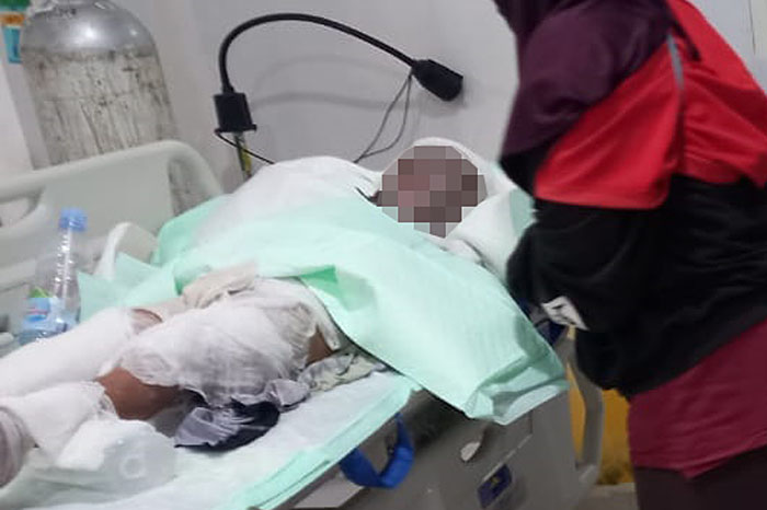 Rizky Maulana, 6, korban luka kebakaran mobil sempat dirawat di RSU Pindad, Sedayu Turen. Tapi, luka bakarnya 80 persen dan akhirnya meninggal