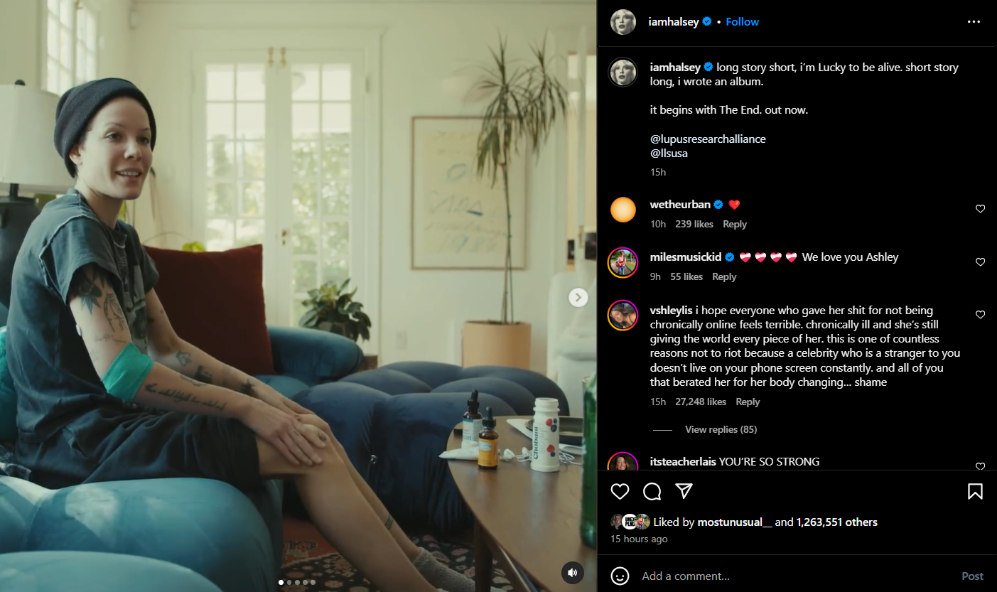 Tangkapan layar Instagram Halsey yang membagikan cerita dirinya terkena lupus.