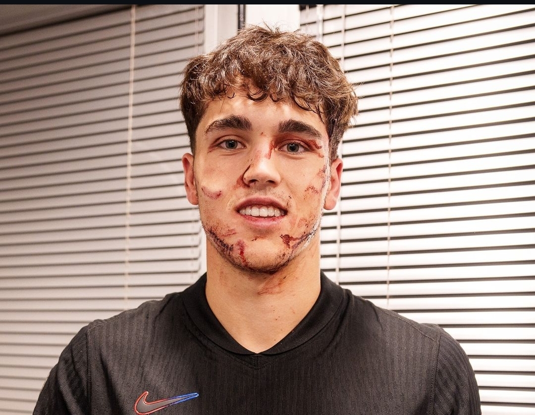 Pau Cubarsi, defender muda FC Barcelona yang berdarah-darah