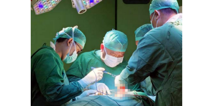 Departemen Orthopaedi dan Traumatologi FKUB/RSUD dr Saiful Anwar melakukan operasi kepada salah satu remaja usia 17 tahun yang mengalami kanker tulang pada 2024 lalu (FKUB/RSSA for Radar Malang).
