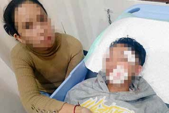 DIUSUT POLISI: MA, pelajar SMK di Kecamatan Klojen menjalani perawatan di rumah sakit sejak 28 Mei lalu.