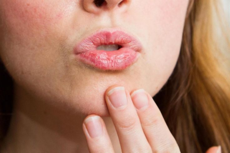 LEMBUT: Perawatan sederhana ini bisa bikin bibir bebas pecah-pecah dan tetap sehat sepanjang hari.