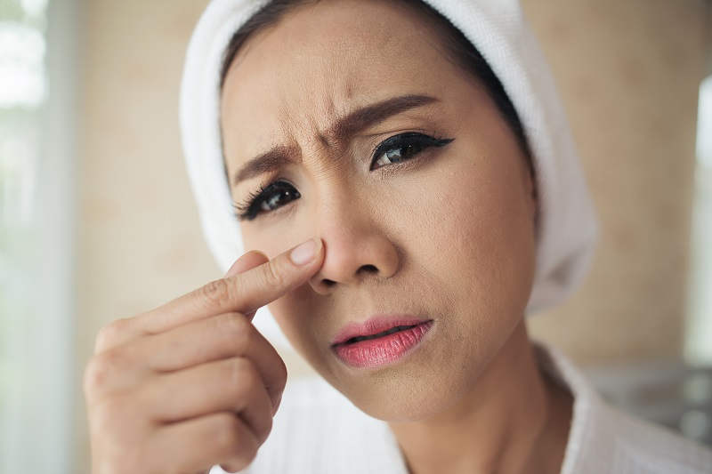 TIPS UNTUK PEMULA: Ini 5 Bahan yang Dapat Memicu Munculnya Komedo saat Salah Memilih Skincare