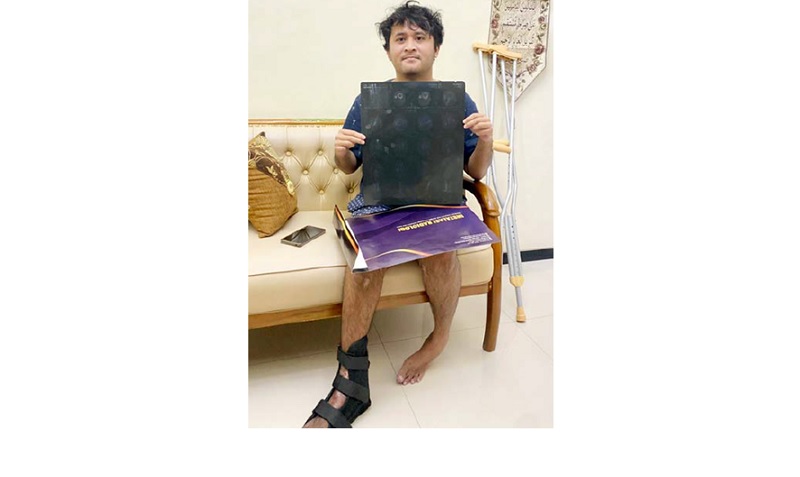 BUTUH KEADILAN: Tino Triessula Sundawa menunjukkan foto rontgen akibat tertabrak bus Shakindra Trans pada 8 Januari 2025 lalu.