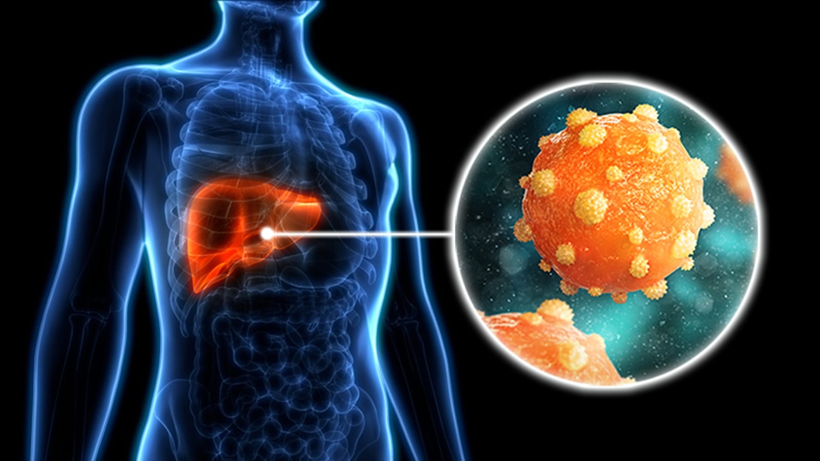 Ilustrasi virus hepatitis b