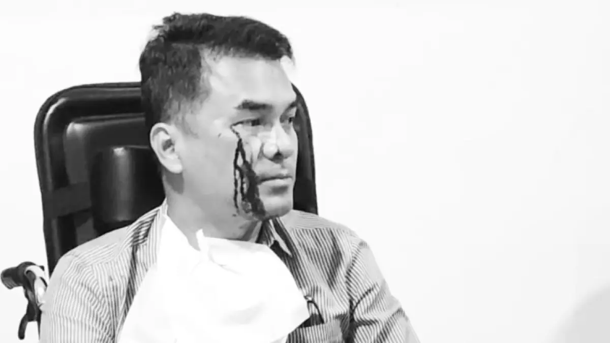 BERDARAH: Kondisi Bro Ron setelah 2 Orang Tersangka Melakukan Pemukulan Akibat Cekcok. (Instagram: brorondm)