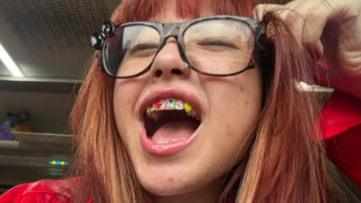 Naykilla pamer gigi centyl (Sumber: Instagram @naykillaaa)