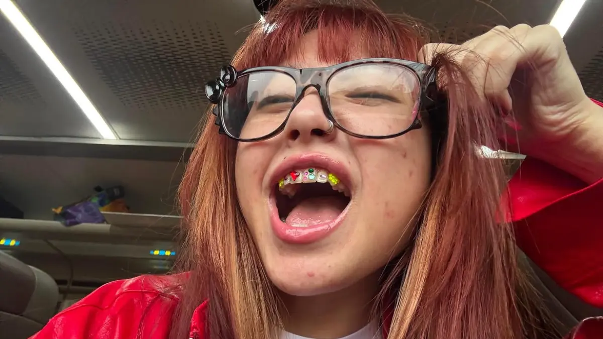 Tooth gems kembali viral setelah dipakai Naykilla (instagram/naykillaaa)