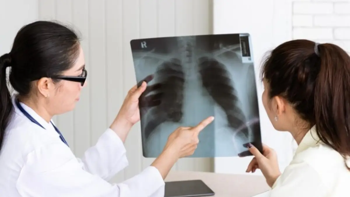 Ilustrasi X Ray