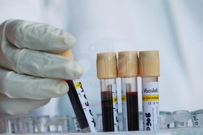 Ilustrasi alat rapid test. Foto: Laoh Mahfud/Radar Malang