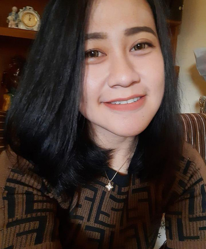 Eva Sofiana, bidan di Klinik Bunga Husada Kecamatan Kalipare yang menjadi korban penyiraman Pertalite dan dibakar di bagian wajah dan dada. (IG/ist)