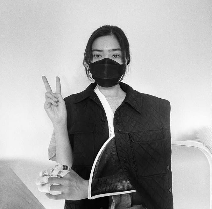 Postingan foto Isyana Sarasvati menunjukkan beberapa luka di bagian tangannya. (Instagram Isyana Sarasvati)