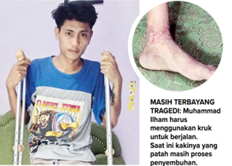 MASIH TERBAYANG TRAGEDI: Muhammad Ilham harus menggunakan kruk untuk berjalan. Saat ini kakinya yang patah masih proses penyembuhan. (NABILA AMELIA/RADAR MALANG)