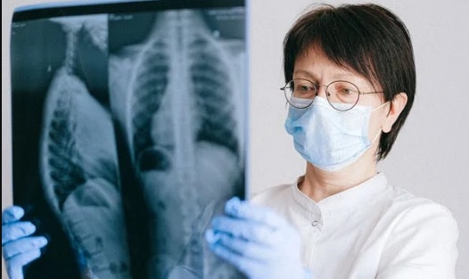 Ilustrasi pemeriksaan hasil rontgen oleh dokter (ist)