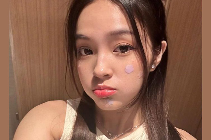 INDAH: Selebgram Aura Eca menjadi salah satu duta pemakai acne patch karakter dengan berbagai warna dan bentuk yang lucu. (foto. dok: Instagram resmi Eca Aura)