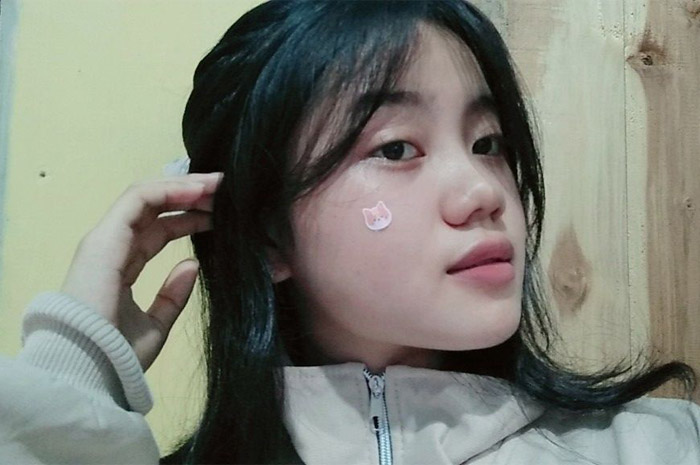 MENAWAN: Kheizia Regina, seorang pelajar yang meminati acne patch karakter guna menambah kepercayaan diri. (foto. dok: Kheizia Regina)