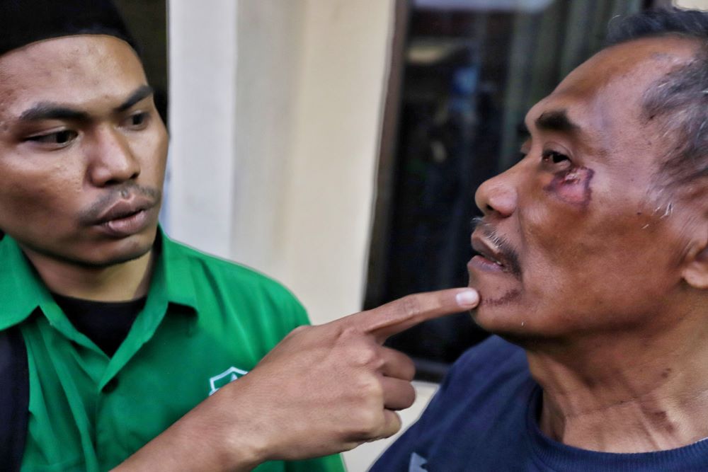 SALAH TANGKAP: Juarianto mengalami luka di wajah. Dia mengaku korban salah tangkap melapor ke Propam Polres Mojokerto Kota, Minggu (14/07).
