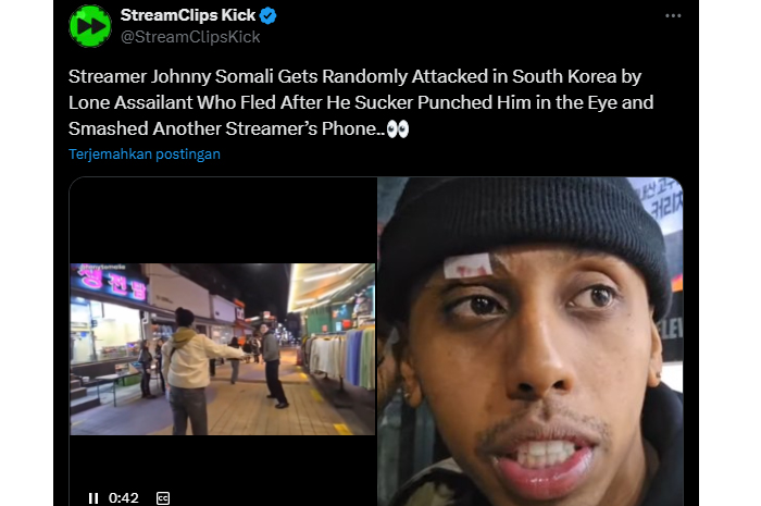 Johnny dipukul warga korsel dan kembali dengan luka di mata kanannya (x: @StreamClipsKick)