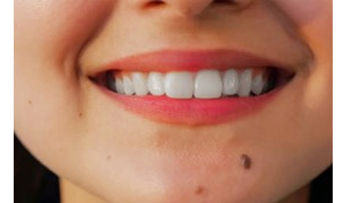 Tahi Lalat di Dekat Bibir Tanda Suka Ghibah, Sedangkan Bibir Tipis Suka Hal Ini