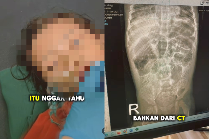 Kondisi Raya Melakukan CT Scan. Kolase foto dari (instagram/rumah_teduh_sahabat_iin)