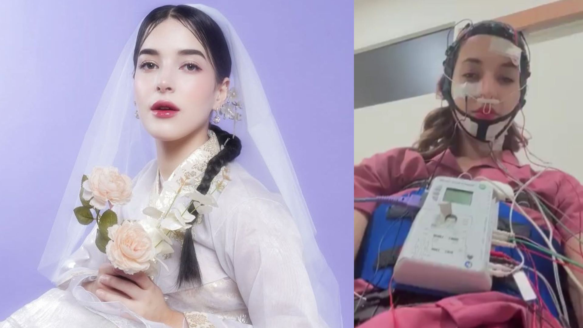 Tasya Farasya, memposting video yang memperlihatkan dirinya sedang menjalani terapi dengan menggunakan  berbagai alat medis di tubuhnya. (instagram: tasyafarasya)