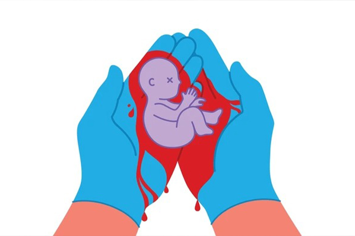 Dalam dunia kesehatan reproduksi, terdapat istilah yang menggambarkan kondisi kehamilan secara spesifik, salah satunya stillborn baby. Sumber foto: Google