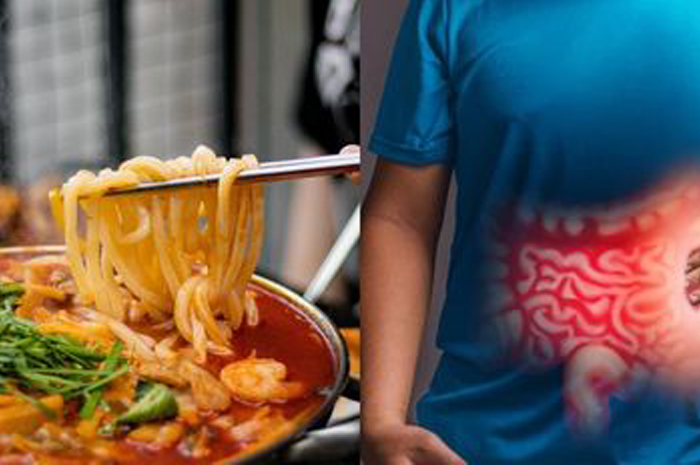 Makan pedas setiap hari bisa meningkatkan nafsu makan, tapi juga berisiko menggangu lambung.