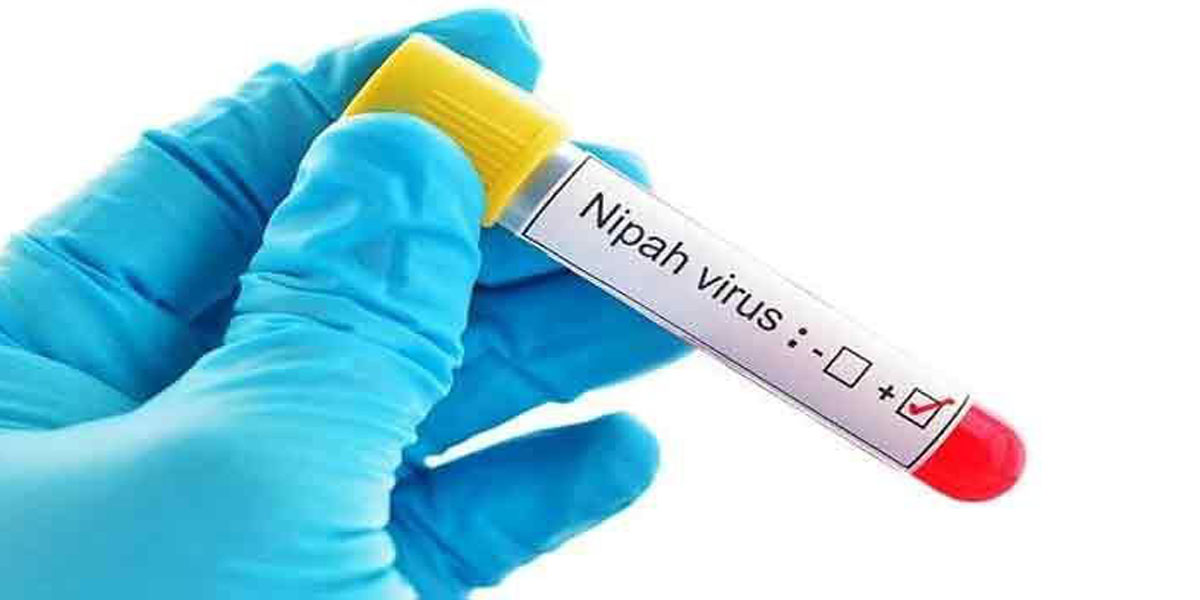 Mengenal Virus Nipah