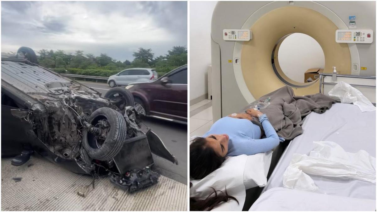 Keadaan mobil dan Diva Siregar  mengalami kecelakaan tunggal di jalan tol hingga mobil terbalik. Kini menjalani pemeriksaan medis. (Foto: dok Instagram divasiregar_)