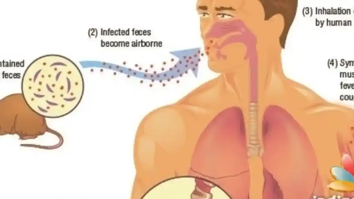Ciri orang yang terjangkit Hantavirus