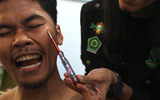 pengobatan-alternatif-energi-listrik-tubuh-pasien-disetrum