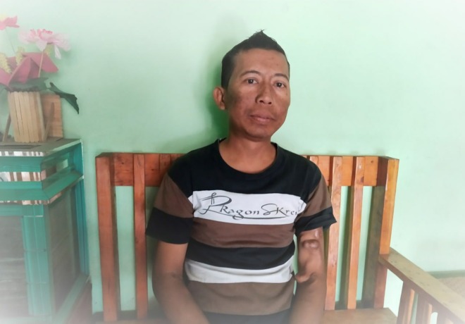 Ali Iksan. (dok jamkesnews.com for JPRM)