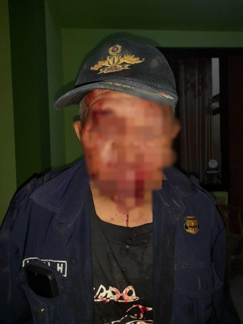 Satpam Gading Intan Babak Belur Dikeroyok Pemuda, Hidung Patah