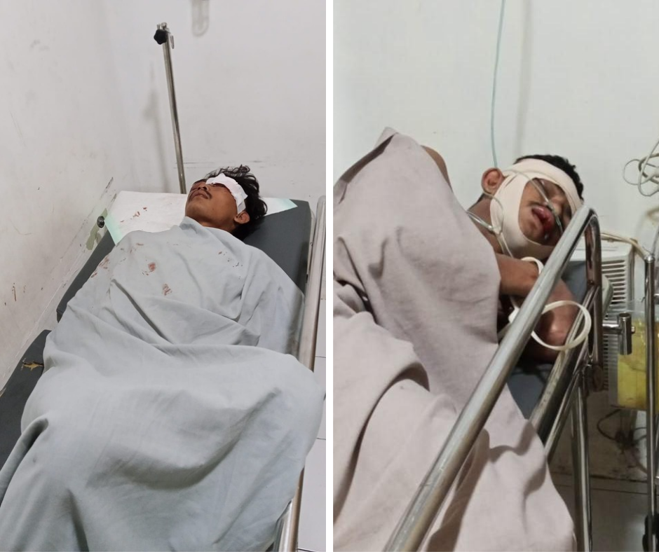 BABAK BELUR : Kedua pelaku terduga kasus curanmor masih mendapatkan perawatan medis usai dihajar masa terpergok mencuri motor di sebuah kos di Dusun Semambung Desa Driyorejo, Kecamatan Driyorejo.