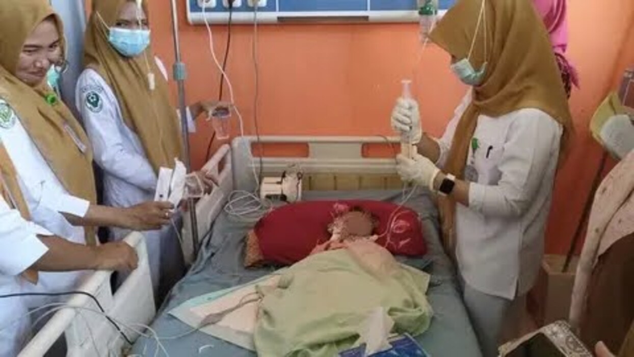 Kondisi bayi di Bengkulu mengeluarkan cacing melalui hidung.