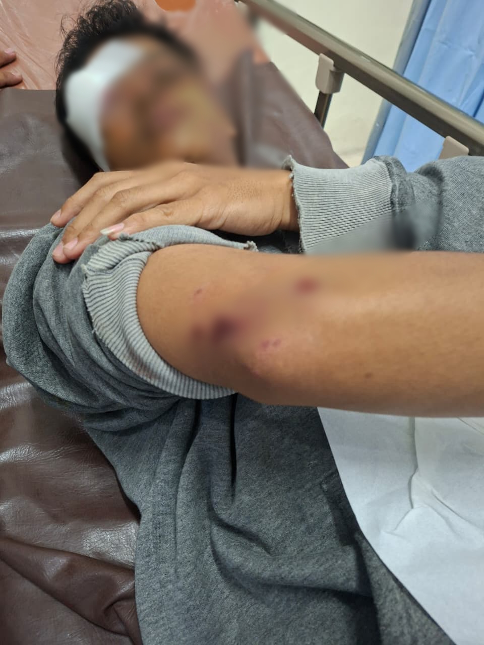 DIRAWAT : Korban inisial ANC saat mendapatkan perawatan medis usai alami luka - luka akibat dikeroyok sekelompok orang tidak dikenal di area SPBU Balongpanggang, Gresik.
