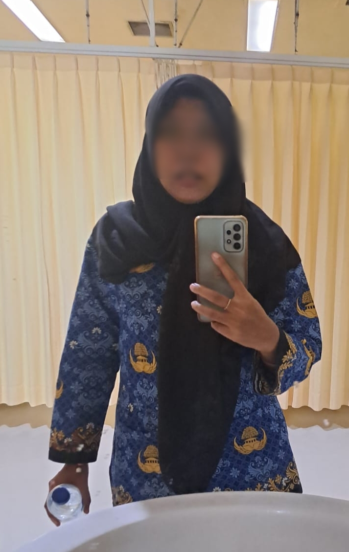 ALAMI LUKA: Korban seorang perempuan inisial DRA yang bekerja sebagai ASN di Pemkab Gresik saat menjalani perawatan medis akibat luka patah tulang hidung usai dugaan kasus penganiayaan.