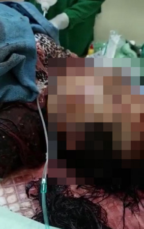 DIRAWAT : Zada Thalita saat mendapatkan kenangan medis di RS Ibnu Sina.  (Istimewa/Radar Gresik)