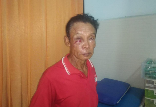 BABAK BELUR: Korban Sudianto saat mendapatkan perawatan medis atas luka yang dialaminya. (Istimewa/Radar Gresik )