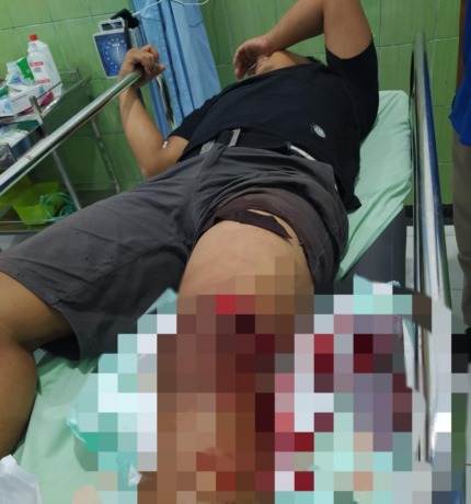 Gresik PERAWATAN: Salah satu korban pengeroyokan mengalami luka sabetan sajam saat menjalani perawatan medis di RS Petrokimia Driyorejo, Selasa (20/9).  (Ist./Radar GresiK)