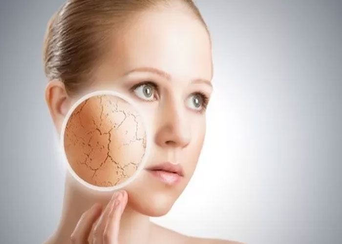 Ilustrasi kulit kering.
