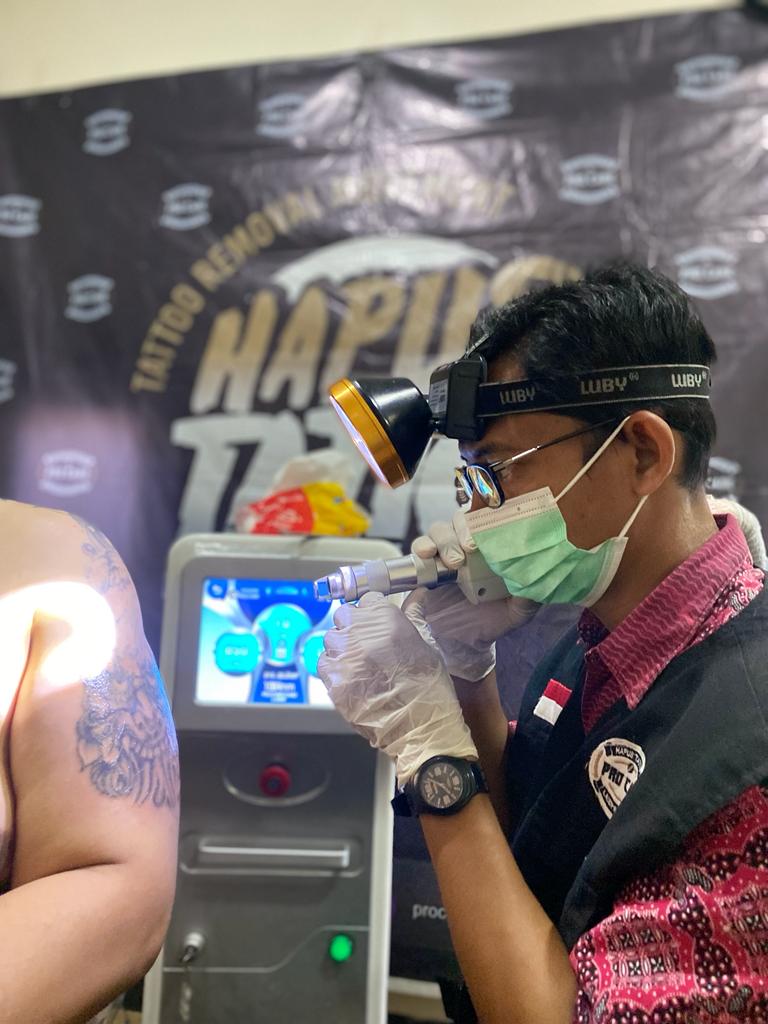 Anggota Komunitas Hapus Tato Pro Care Klaten menghapus tato belum lama ini. (HAPUS TATO PRO CARE KLATEN UNTUK RADAR SOLO)