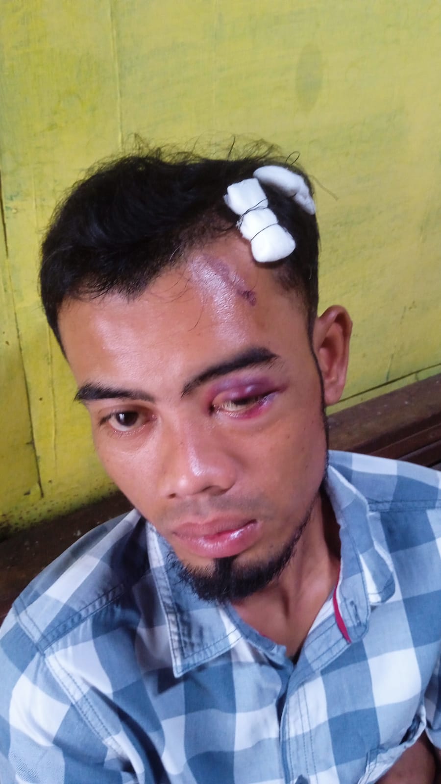 Hananto, warga Kelurahan Kepatihan Wetan, Kecamatan Jebres, Kota Solo babakbeluar dianiaya seseorang yang dikenalnya.