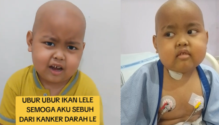 Devin, bocah 6 tahun yang viral disebut jadi pemenang sound ubur-ubur ikan lele kerap membagikan cerita perjuangannya melawan kanker darah.