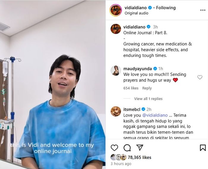 Vidi Aldiano Ungkap Kabar Terbaru Tentang Kanker Ginjal yang Dideritanya, Hasilnya Tidak Sesuai Harapan